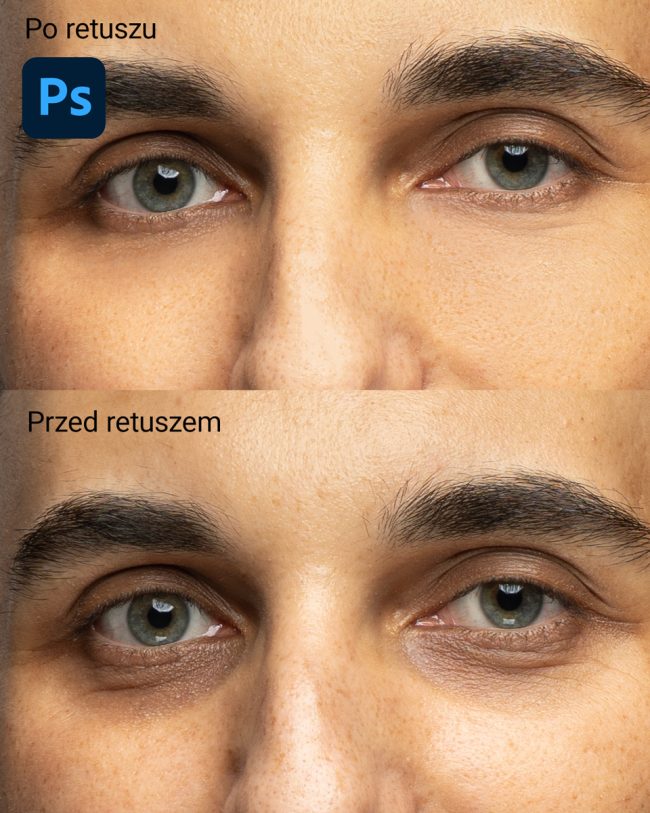 przed-po